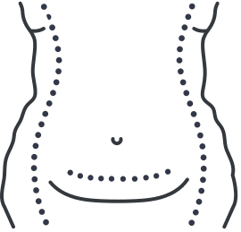 body 1 fat freezing results icon