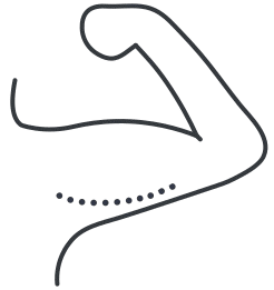 upper arms fat freezing results icon