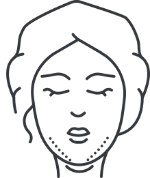 face fat freezing results icon