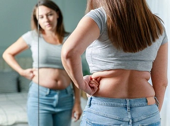 fat freezing Liverpool